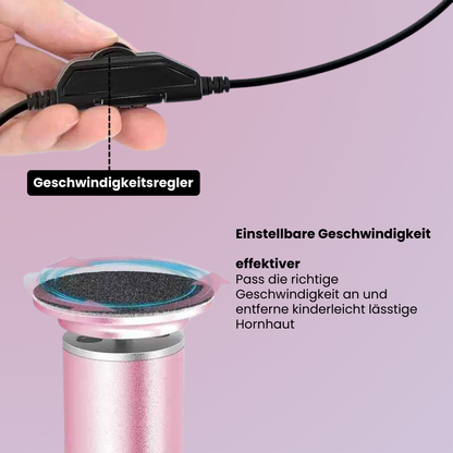 ShinyFeet - Das Ende rauer Füße