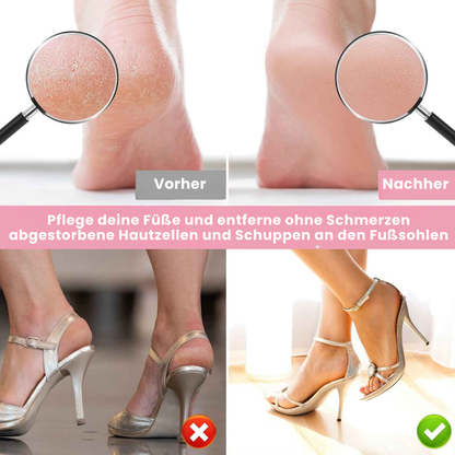 ShinyFeet - Das Ende rauer Füße