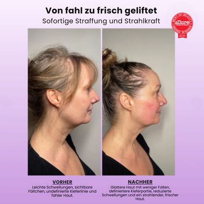 Mylift - Deine tägliche Anti-Aging-Routine