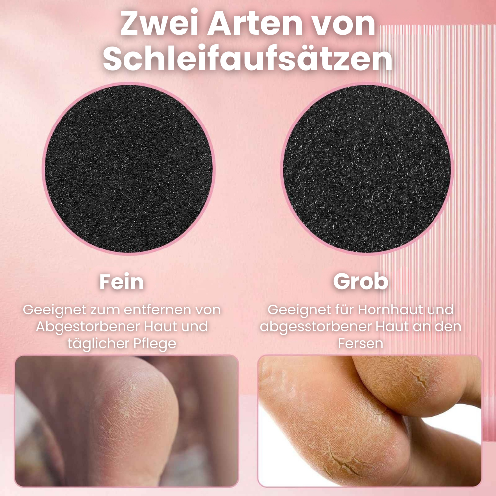 ShinyFeet - Das Ende rauer Füße